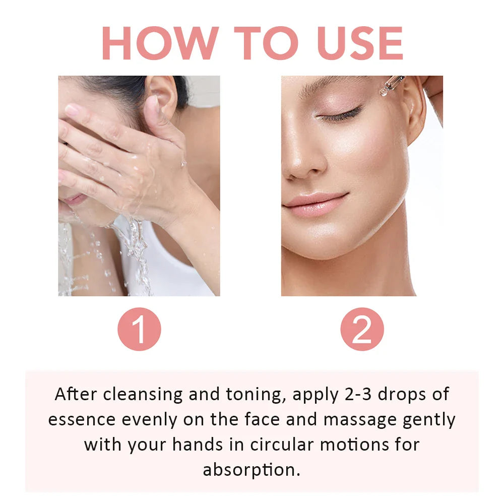 30ml Niacinamide Serum – Dark Spot Corrector, Melanin Removal & Pore-Shrinking Hydrating Skin Care