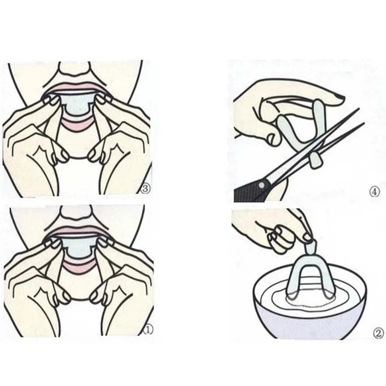 Silicone Dental Night Guard – Cold Light Whitening Braces Tray for Teeth Grinding Protection and Gum Cushion