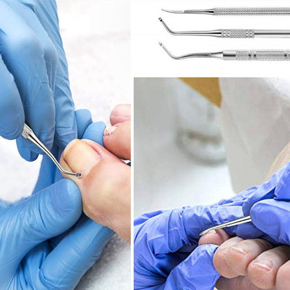 3PCS Stainless Steel Ingrown Toenail Tool Kit – Toenail File, Lifters, and Pedicure Tools for Pain Relief and Nail Care