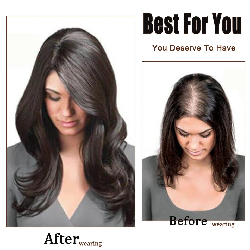 Dazzeal Human Hair Topper – 100% Real Straight Hair, Lace Base, Clip-In with Bangs, 10x12cm, 360° Coverage