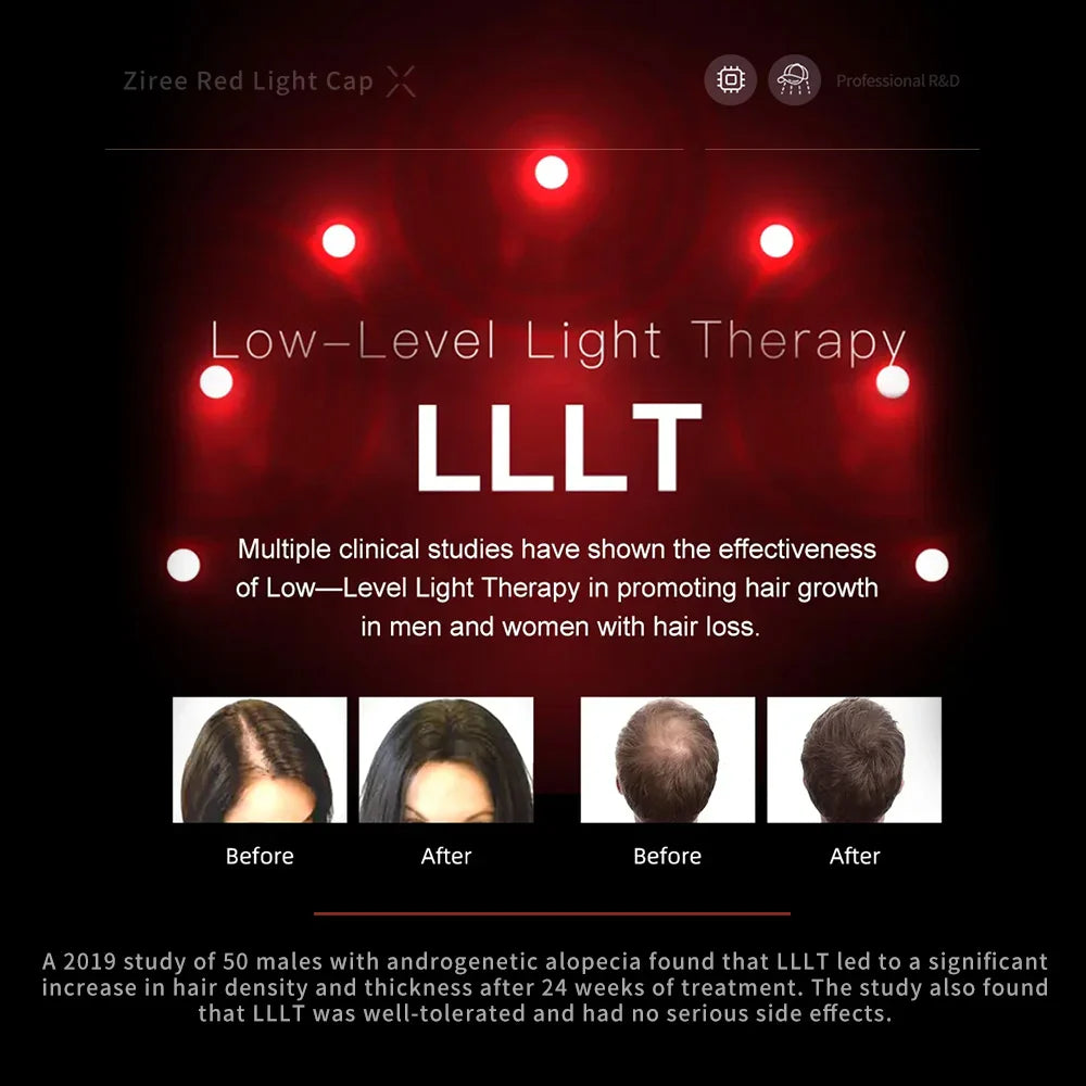 Laser Hair Growth Cap – 94/128/208 Laser Irradiation for Rapid Hair Growth & Oil Control, Remarkable Results