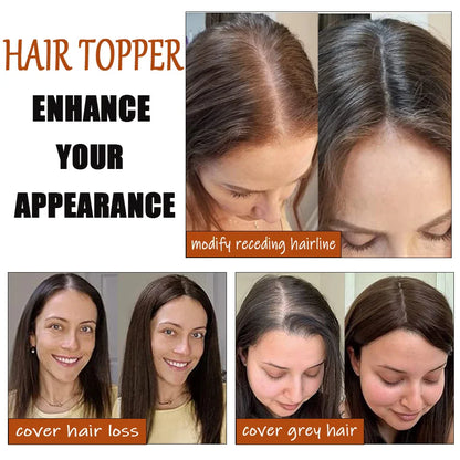 Dazzeal Human Hair Topper – 100% Real Straight Hair, Lace Base, Clip-In with Bangs, 10x12cm, 360° Coverage