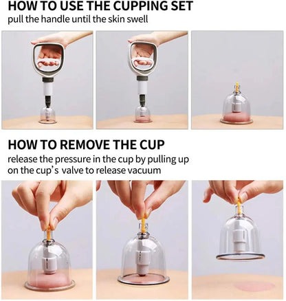 Cupping Therapy Set — Vacuum Suction Cups for Massage, Anti-Cellulite & Physiotherapy Body Treatment