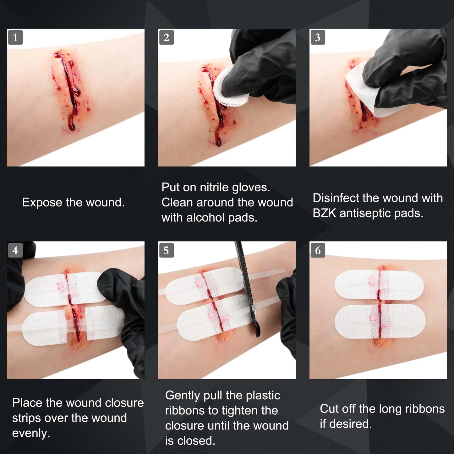 RHINO RESCUE Zip Stitch Laceration Closure Kit — Wound Closure Strips with Dressings, Suture-Free Care
