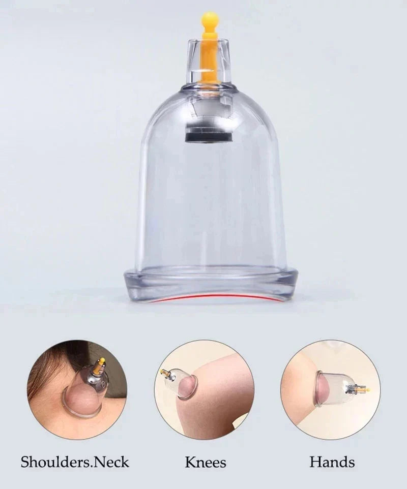Cupping Therapy Set — Vacuum Suction Cups for Massage, Anti-Cellulite & Physiotherapy Body Treatment