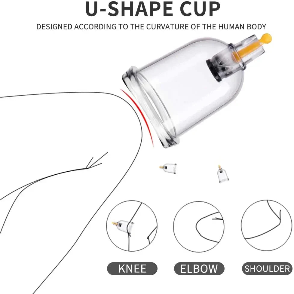 Cupping Therapy Set — Vacuum Suction Cups for Massage, Anti-Cellulite & Physiotherapy Body Treatment