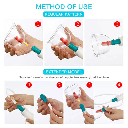 Cupping Therapy Set — Vacuum Suction Cups for Massage, Anti-Cellulite & Physiotherapy Body Treatment