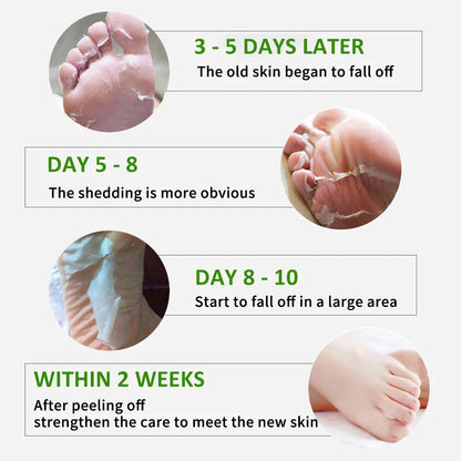FlowWeek Exfoliating Foot Mask – Removes Dead Skin, Calluses & Dry, Chapped Feet for Smooth, Soft Skin