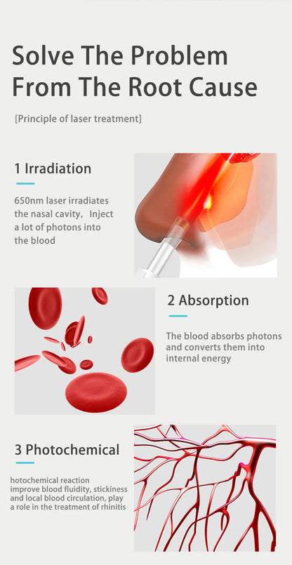 Tinnitus Ear Laser Therapy – 650nm Irradiation Physiotherapy Earplug for Otitis Media & Deafness Treatment, USB Interface
