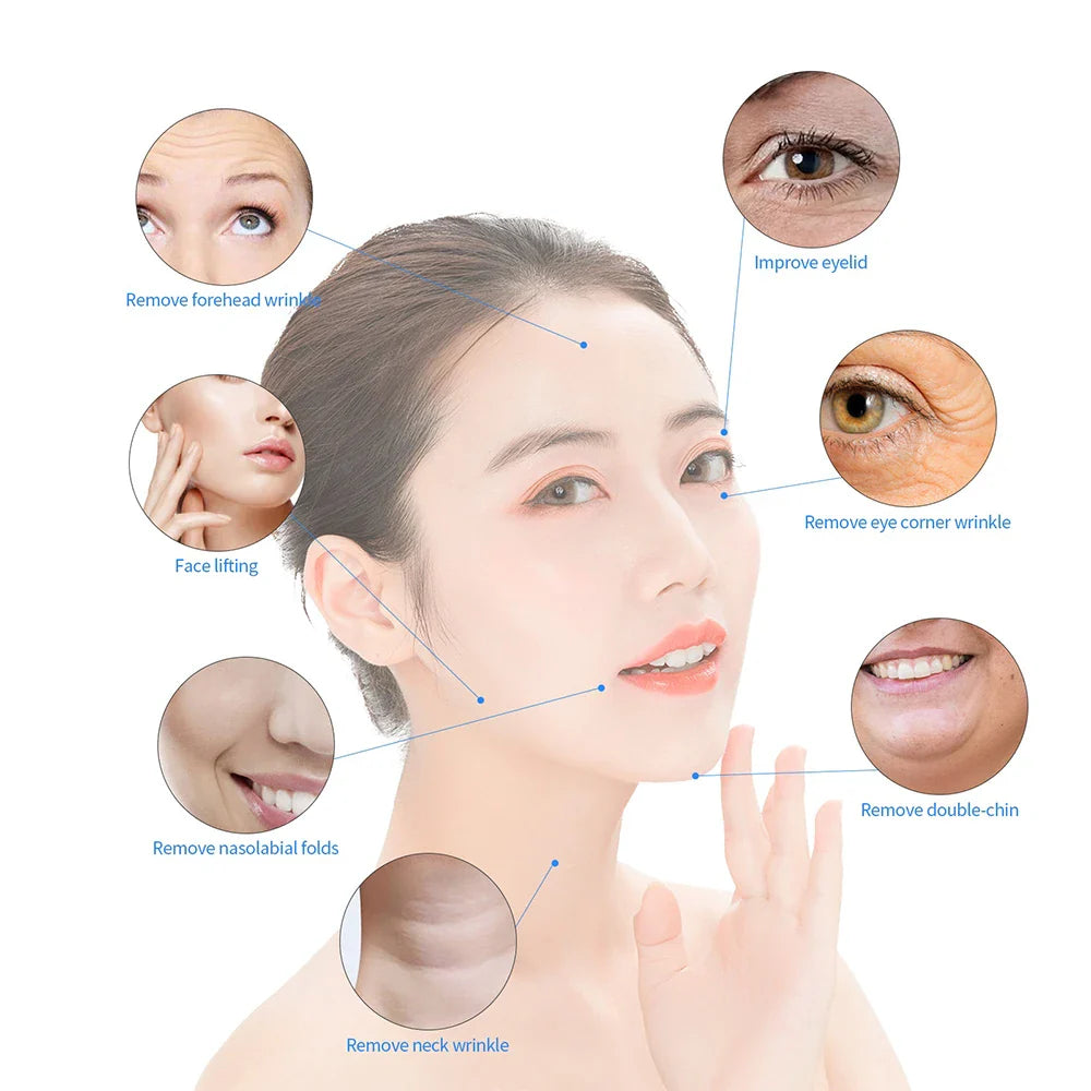 5MHz Radio Frequency RF Lifting Machine – Tripolar RF Facial and Body Device for Skin Tightening, Eye Care, and Neck Wrinkle Removal