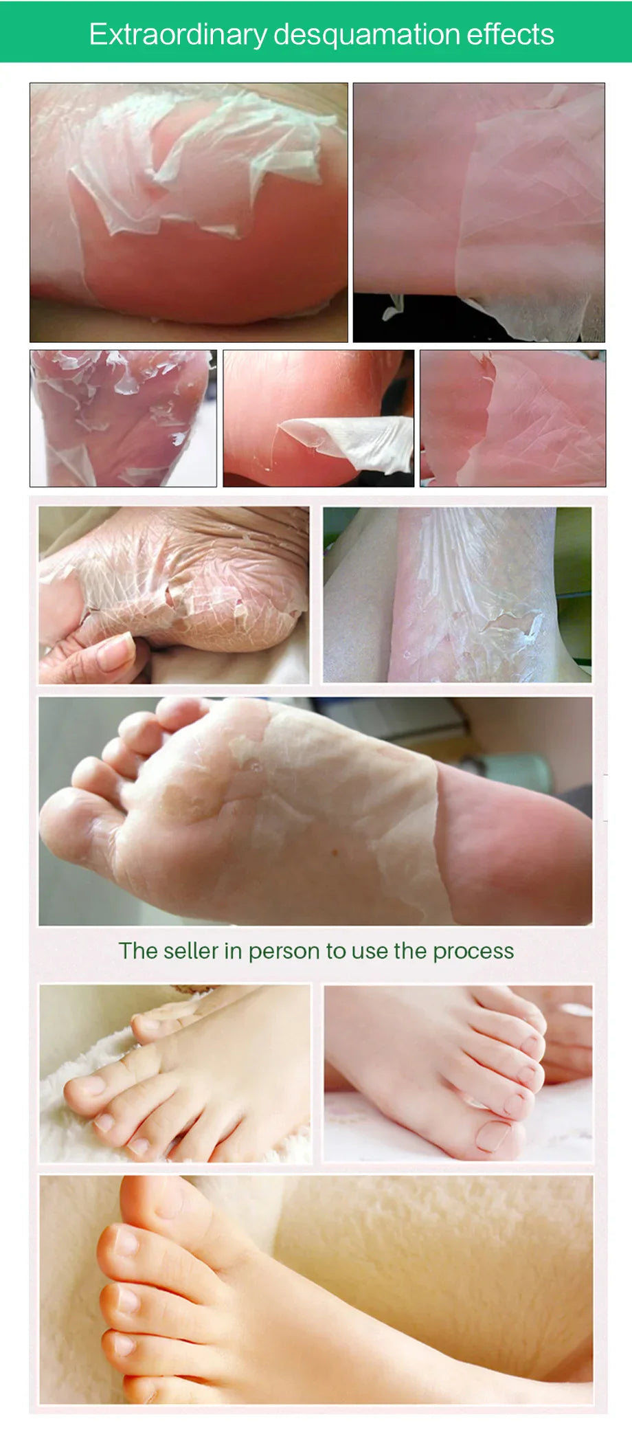 Aloe Vera Foot Mask & Peeling Socks – Exfoliating Scrub for Legs & Feet, Anti-Crack Heel Treatment, Pedicure Skin Removal Patch