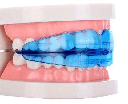T4K Children’s Dental Tooth Trainer – Orthodontic Appliance for Kids Teeth Alignment, Soft & Hard Braces Mouthpieces