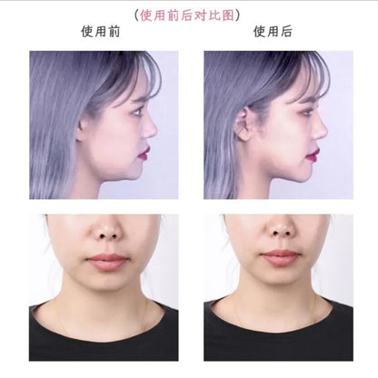 40PCS Invisible Face Lift Tape Stickers – Thin V-Shape Facial Adhesive Strips for Skin Tightening, Wrinkle & Sagging Support