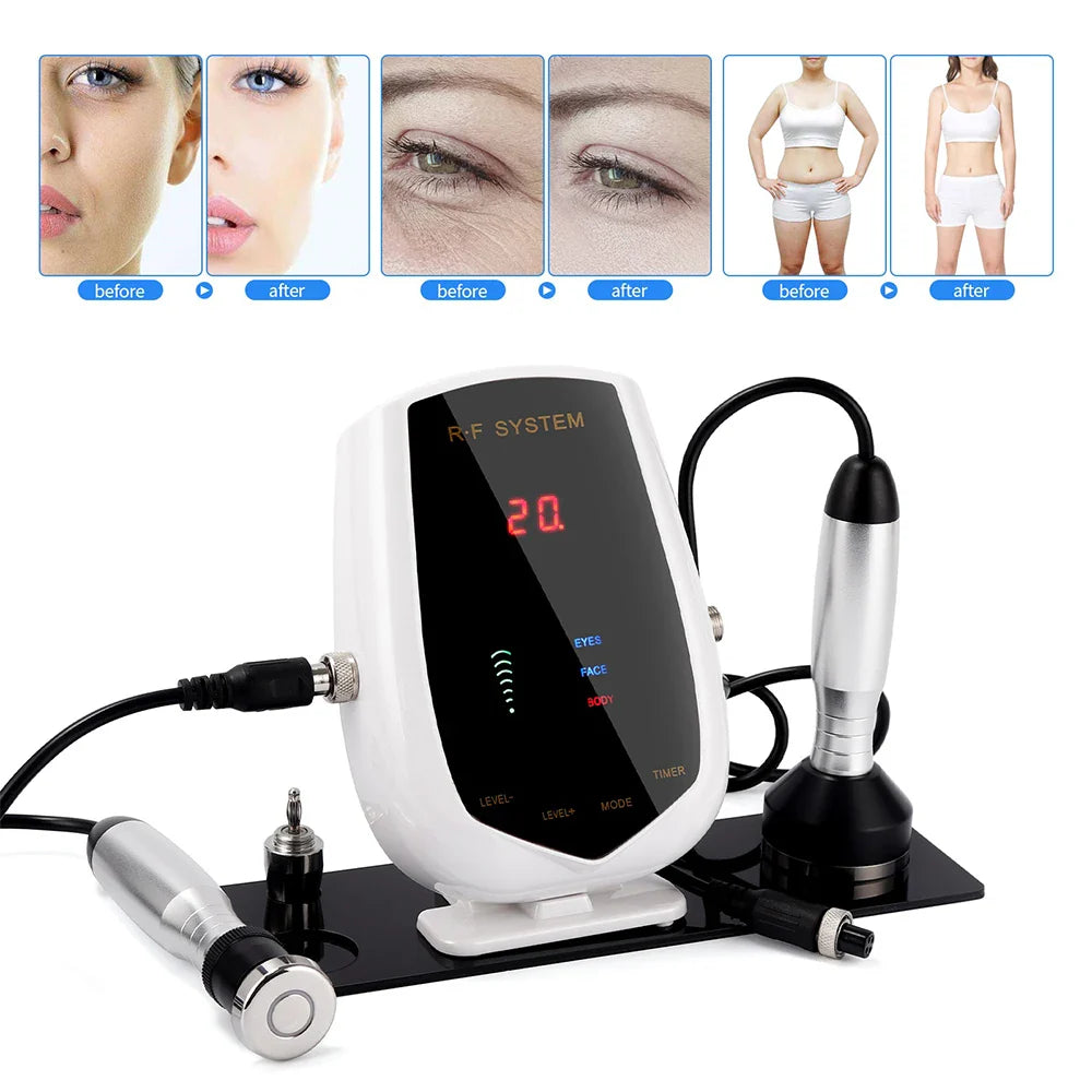 5MHz Radio Frequency RF Lifting Machine – Tripolar RF Facial and Body Device for Skin Tightening, Eye Care, and Neck Wrinkle Removal