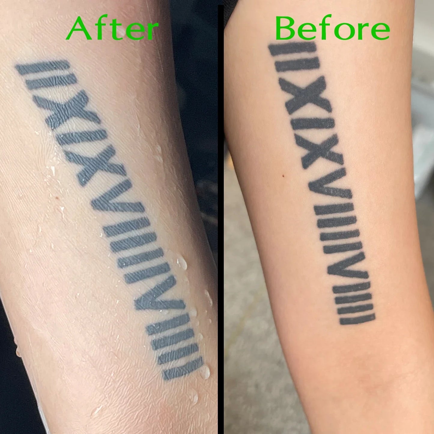 EZ Premium Derm Defender – Waterproof Clear Adhesive Tattoo Aftercare Protective Film