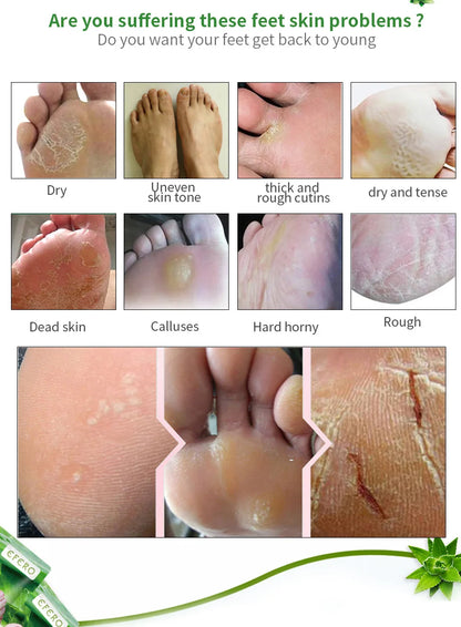 Aloe Vera Foot Mask & Peeling Socks – Exfoliating Scrub for Legs & Feet, Anti-Crack Heel Treatment, Pedicure Skin Removal Patch