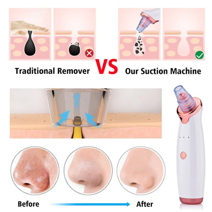 Electric Facial Blackhead Remover: Vacuum Pore Cleaner for Acne Cleansing & Black Spot Removal - Deep Cleaning Tools for Face and Nose