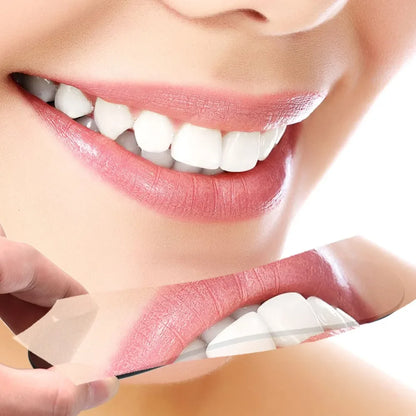 5pcs Dentistry Orthodontic Double-Sided Mirrors – Glass Intra Oral Reflector Photography Tools
