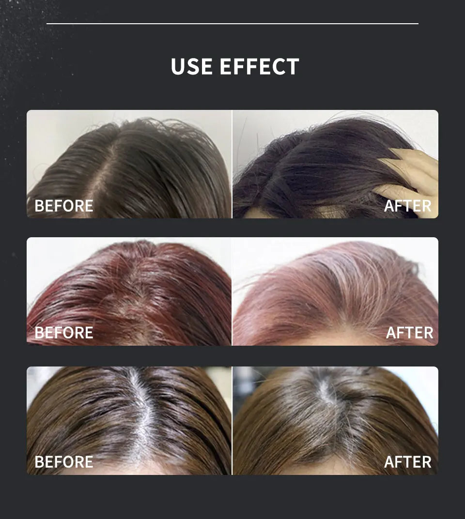 Sevich Unisex Dust It Hair Powder Spray – Increases Volume & Adds Fluff for Thin Hair, Haircut Styling Hairspray