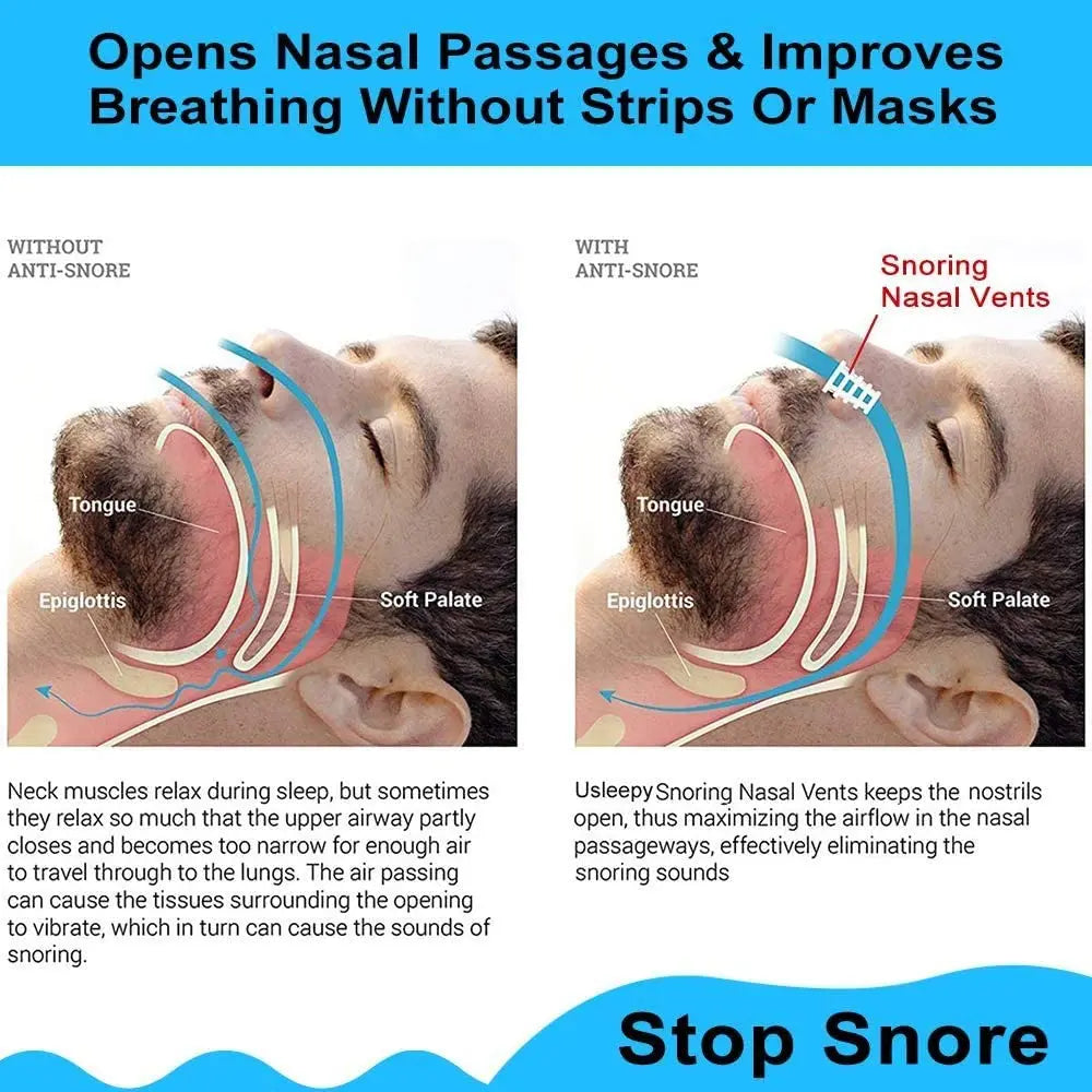 8PCS Anti-Snoring Nose Clips – Nasal Dilator Silent Sleep Aid Device for Men