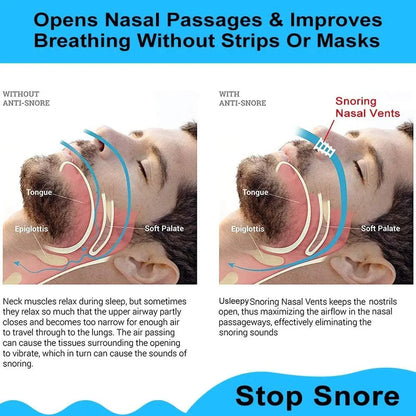 8PCS Anti-Snoring Nose Clips – Nasal Dilator Silent Sleep Aid Device for Men