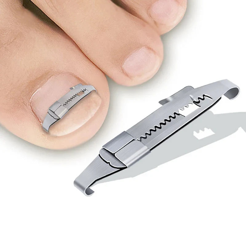 Professional Ingrown Toenail Corrector Tools - Pedicure Recovery, Embed Toe Nail Treatment, Foot Care Tool for Ingrown Toenail Correction