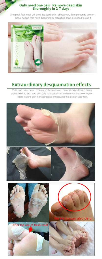 Aloe Vera Foot Mask & Peeling Socks – Exfoliating Scrub for Legs & Feet, Anti-Crack Heel Treatment, Pedicure Skin Removal Patch