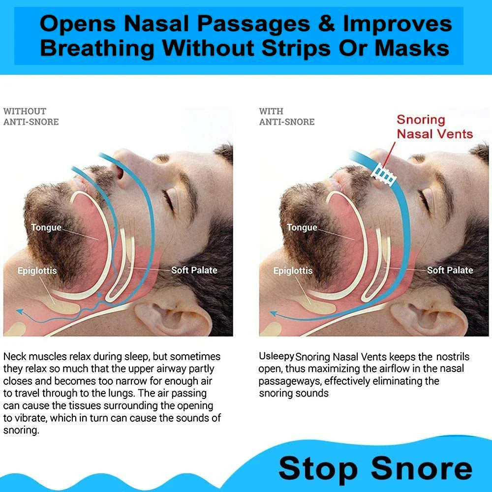 8PCS Anti-Snoring Nose Clips – Nasal Dilator Silent Sleep Aid Device for Men