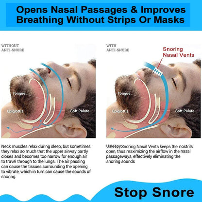 8PCS Anti-Snoring Nose Clips – Nasal Dilator Silent Sleep Aid Device for Men