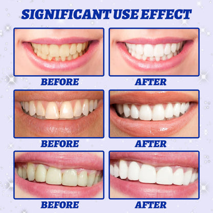 5D Whitening Teeth Stickers – 7/14 Pairs Gel Strips for Stain Removal, Dental Bleaching & Oral Hygiene Care