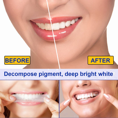 5D Whitening Teeth Stickers – 7/14 Pairs Gel Strips for Stain Removal, Dental Bleaching & Oral Hygiene Care