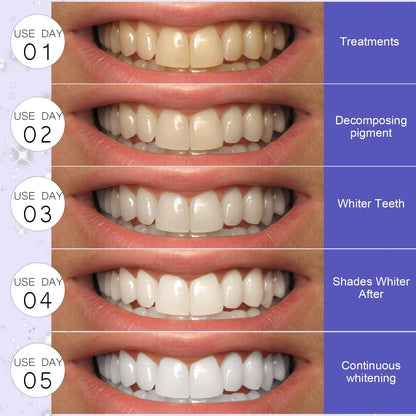 5D Whitening Teeth Stickers – 7/14 Pairs Gel Strips for Stain Removal, Dental Bleaching & Oral Hygiene Care