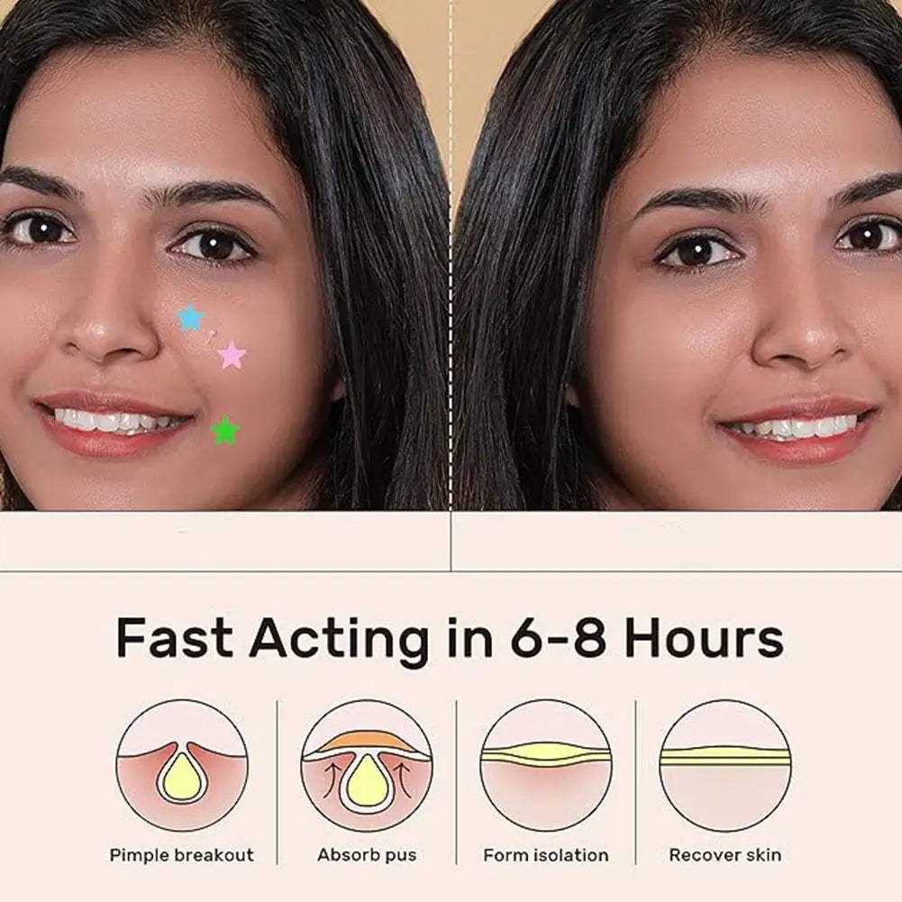 Colorful Star Pimple Patches – Invisible Acne Spot Stickers for Skin Care, Concealer & Makeup Tools