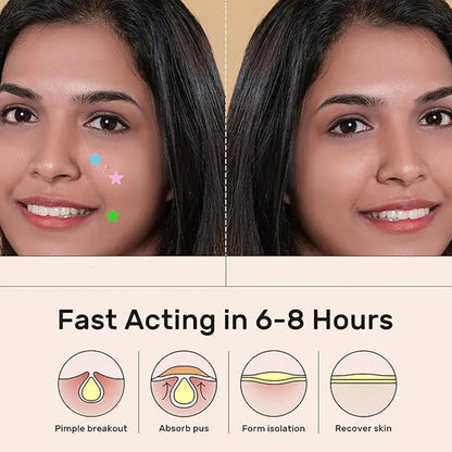 Colorful Star Pimple Patches – Invisible Acne Spot Stickers for Skin Care, Concealer & Makeup Tools