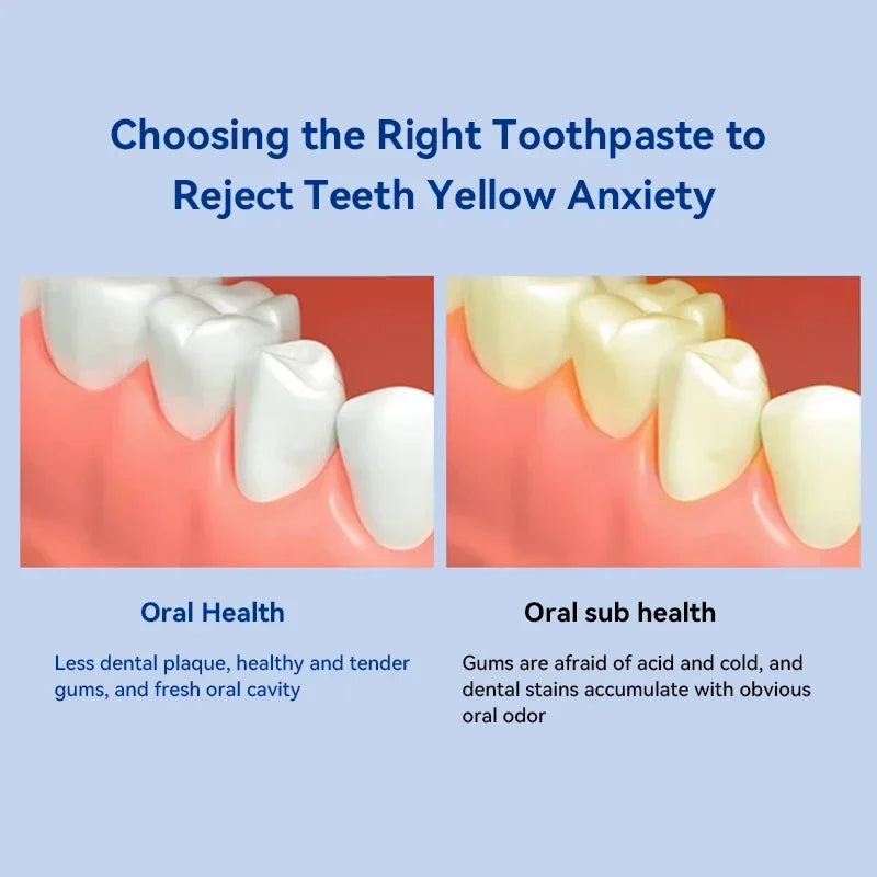 Dental Calculus Remover Toothpaste – Whitening, Bad Breath Removal & Periodontitis Prevention for Teeth Car