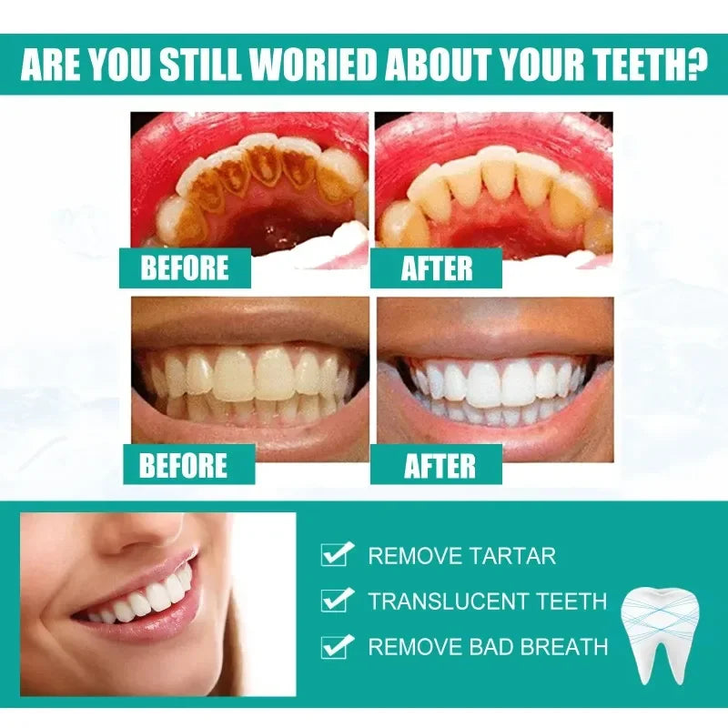 5 Day Teeth Whitening Powder – Removes Plaque & Stains, Deep Cleaning, Fresh Breath & Oral Hygiene Care