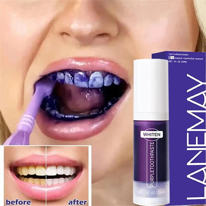 V34 Teeth Whitening Toothpaste – 5D Whitening Stick for Oral Hygiene, Cleaning & Fresh Breath Care