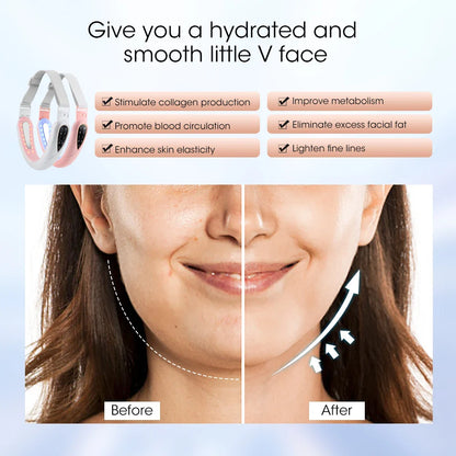 Face Lifting Device with Red Light — V-Face Massager for Double Chin Lift & Skin Rejuvenation, Remote-Controlled Facial Beauty Tool