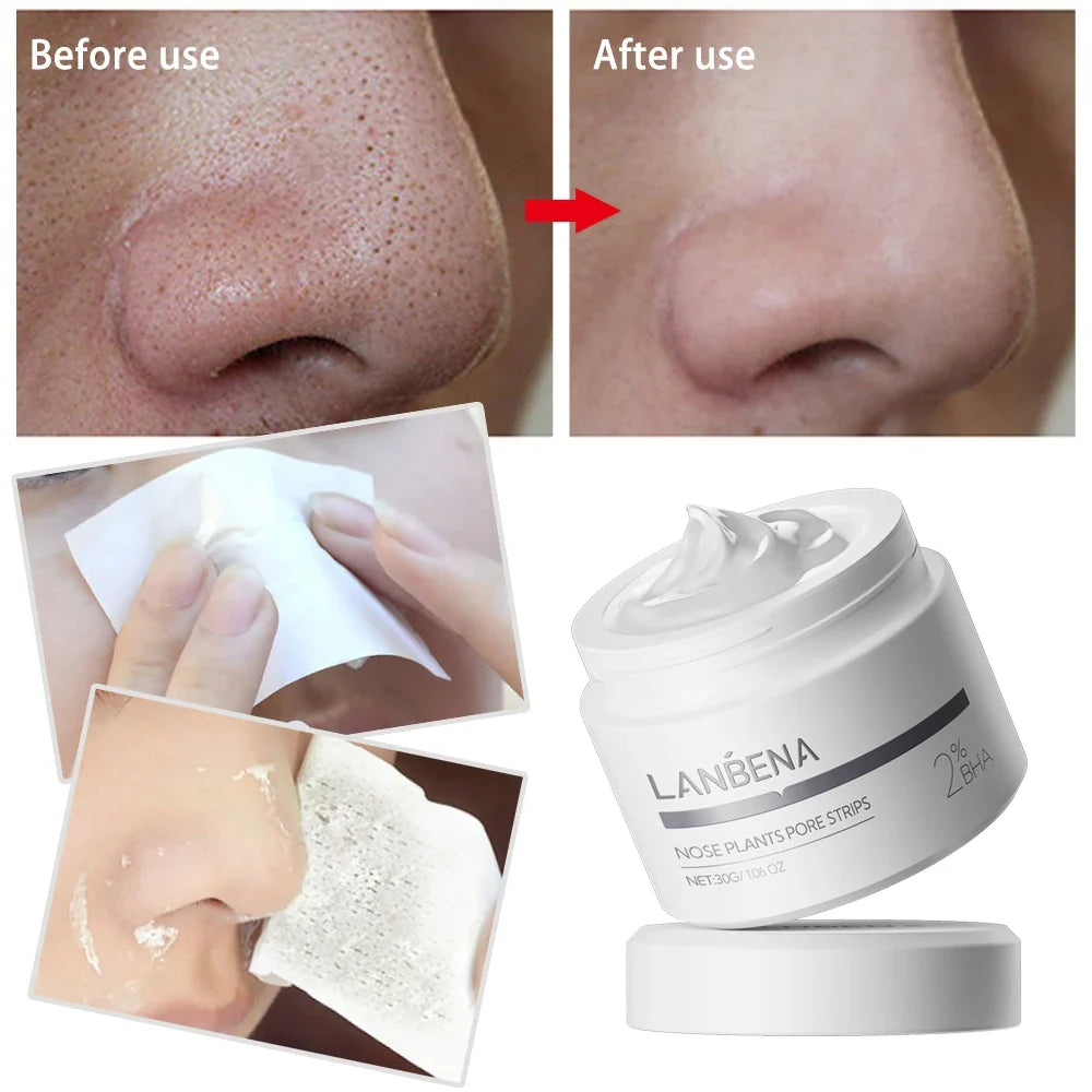LANBENA Blackhead Remover Nose Pore Strips – Deep Cleansing Oil Control Peel-Off Face Mask (60 Stickers)