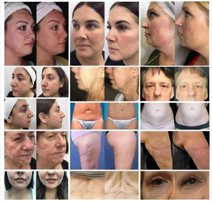 Facial Beauty Machine – Skin Care Device for Rejuvenation and Treatment