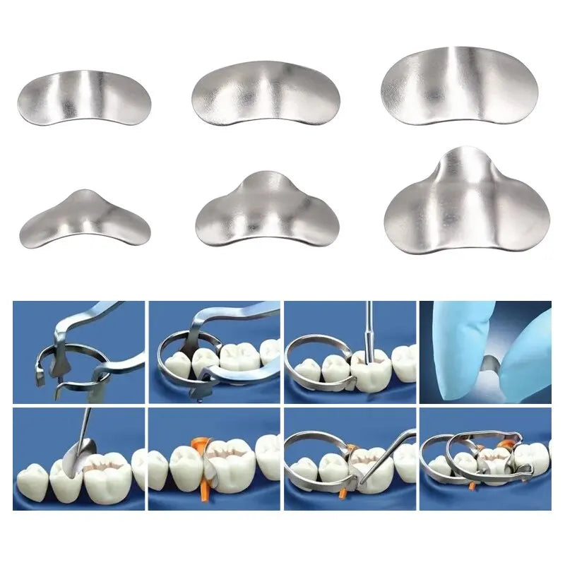 Denspay 100pcs/Box Dental Sectional Matrix System - Resin Clamping/Seperating Ring - Dentist Tools