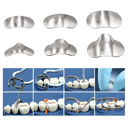Denspay 100pcs/Box Dental Sectional Matrix System - Resin Clamping/Seperating Ring - Dentist Tools