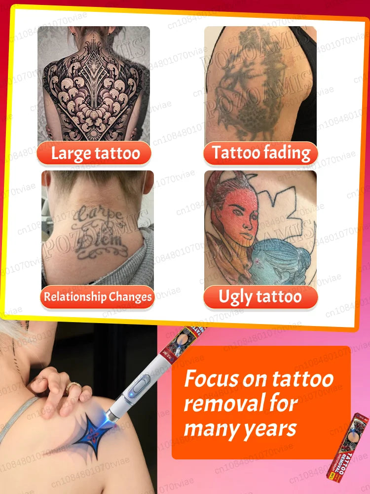 Blue Light Tattoo Removal Pen – Unisex, Suitable for All Ages, Free Shipping