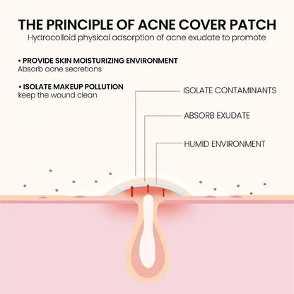 Acne Repair Patch - Facial Skin Care for Blemish & Pimple Marks, Acne Treatment & Pimple Repair Cover