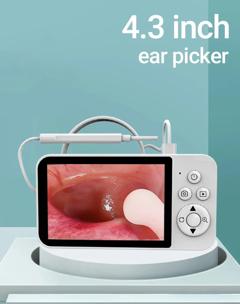 DDCAMERA 4.3" Digital Otoscope – 1080P Ear Scope with 6 LED Lights for Ear Wax Removal, Photo & Video Support