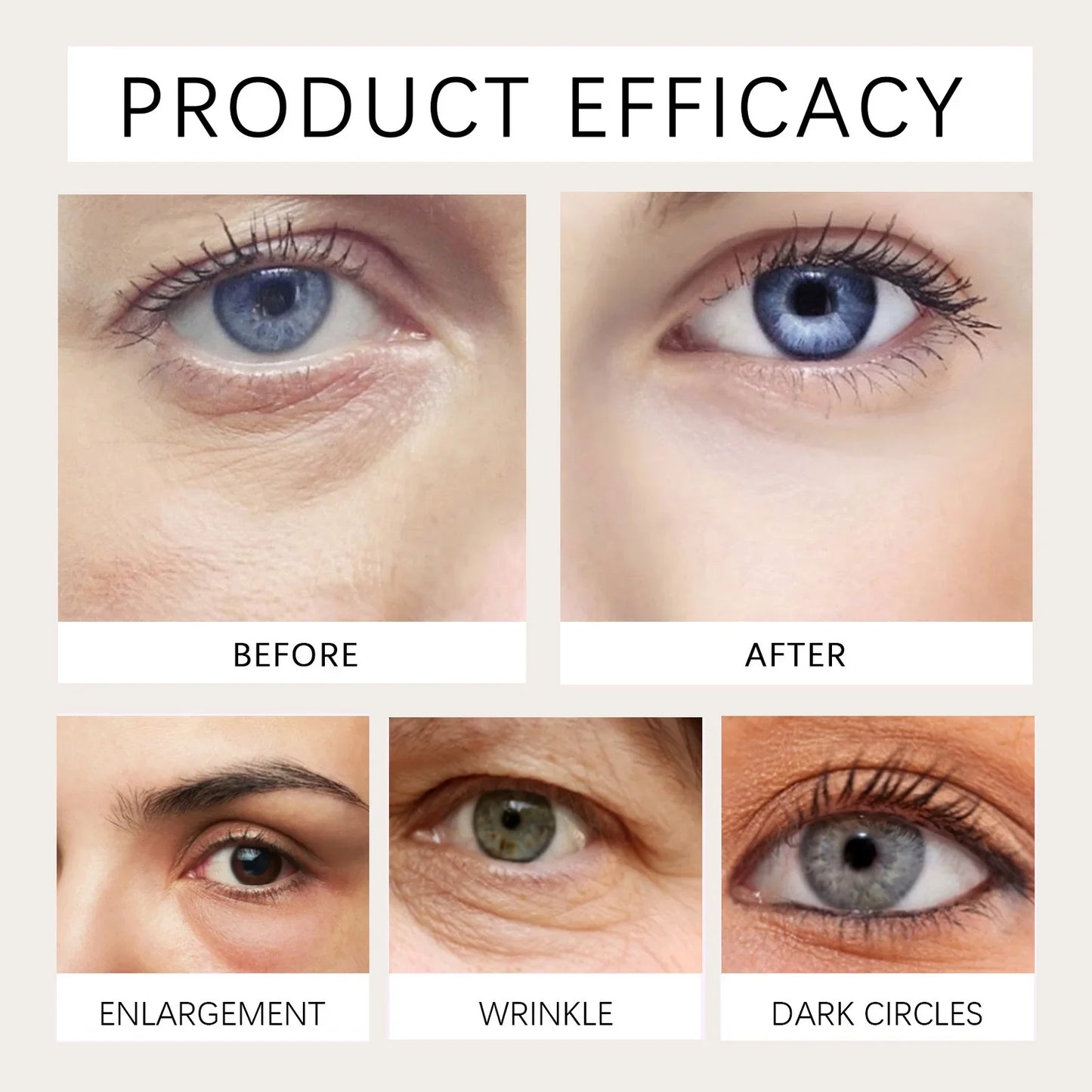 Castor Oil Eye Serum – Anti-Wrinkle, Dark Circle & Puffiness Treatment