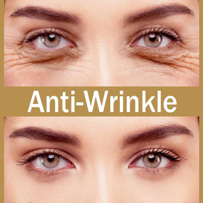 Micro-Needle Hyaluronic Acid Eye Patch – Anti-Wrinkle Moisturizing Eye Mask for Fine Lines Removal