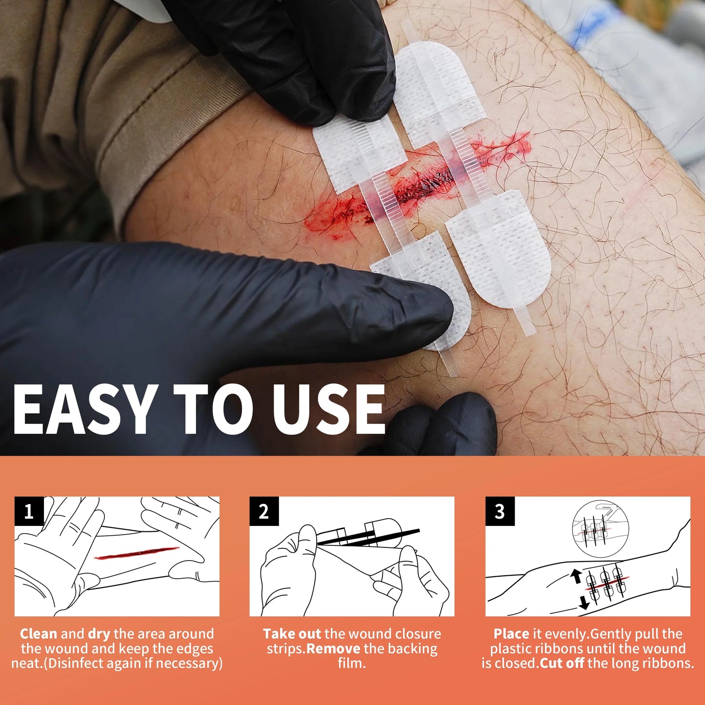 RHINO RESCUE Zip Stitch — Wound Closure Strips, Adhesive Bandages for Cut Care Without Sutures