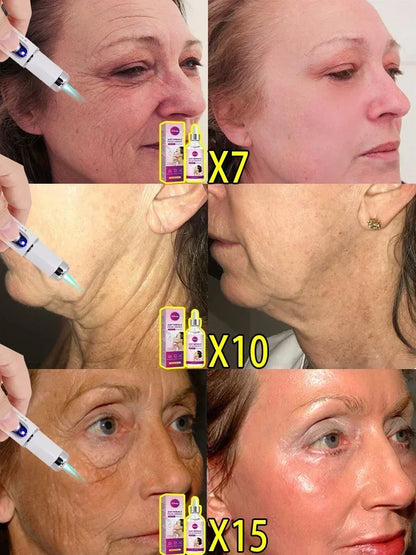 Laser Skin Treatment Device — Professional Solution for Facial Skin Problems