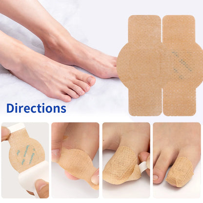 21/105pcs Waterproof Nail Fungus Repair Patches — Ingrown Nail Correction Stickers for Damaged Nail & Feet Care